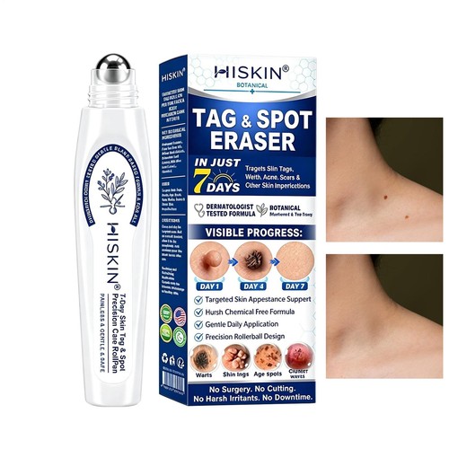 Hiskin day skin tag spot - day,